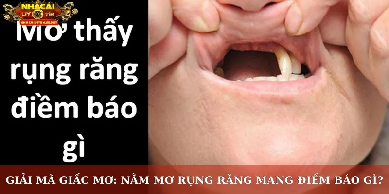 Giải mã giấc mơ: Nằm mơ rụng răng mang điềm báo gì?